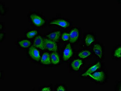 CCR10 antibody