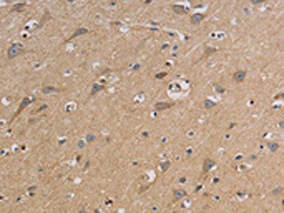 CCR2 Antibody