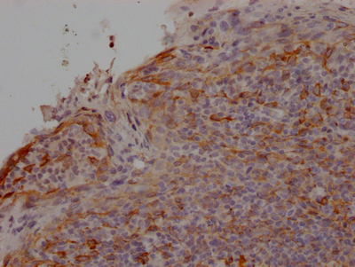 CCR2 Recombinant Monoclonal Antibody