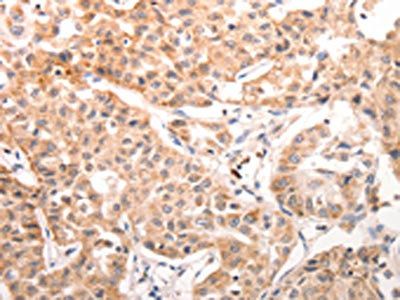 CCR3 Antibody