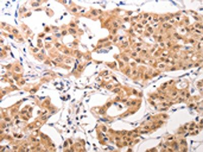CCR3 Antibody