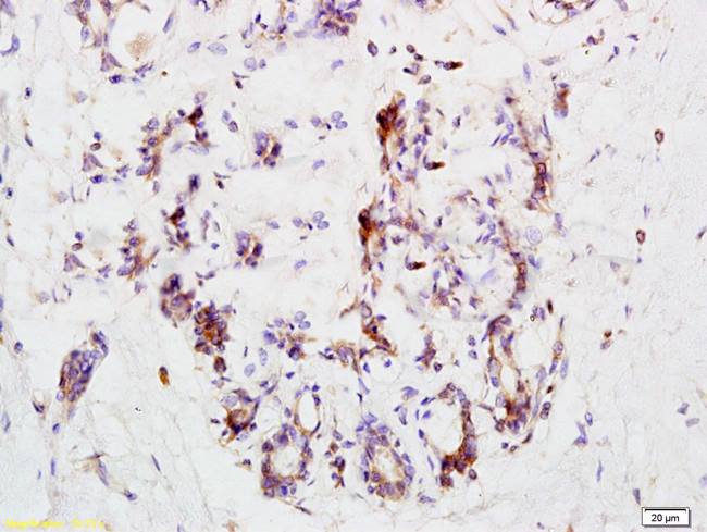 CCR3 Rabbit Polyclonal Antibody