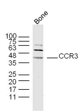 CCR3 Rabbit Polyclonal Antibody