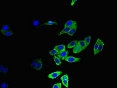 CCR5 antibody