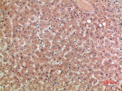 CCR5 antibody