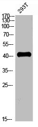 CCR5 antibody