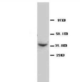 C-C chemokine receptor type 5 CCR5 Antibody
