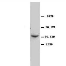 Anti-C-C chemokine receptor type 5 CCR5 Antibody
