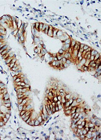 Anti-C-C chemokine receptor type 5 CCR5 Antibody