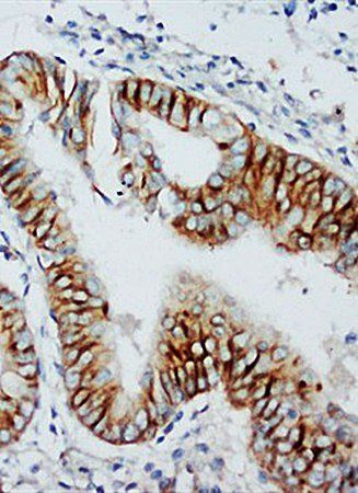 C-C chemokine receptor type 5 CCR5 Antibody