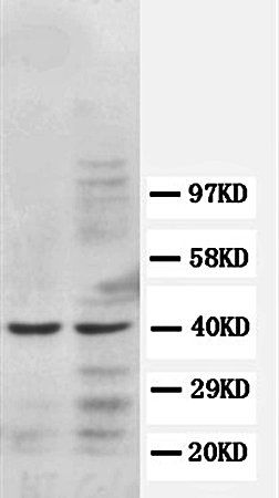 Anti-C-C chemokine receptor type 5 CCR5 Antibody