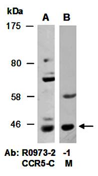 CCR5 (C) Antibody, Rabbit Polyclonal