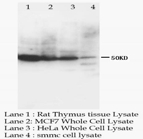 Anti-CCR6/CCR6 Antibody