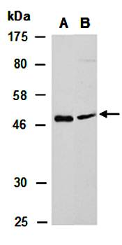 CCR7 (N) Antibody, Rabbit Polyclonal