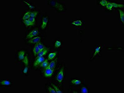 CCR7 antibody