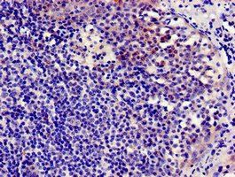 CCR7 Antibody