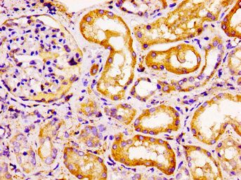 CCRL2 Antibody