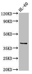 CCRL2 antibody