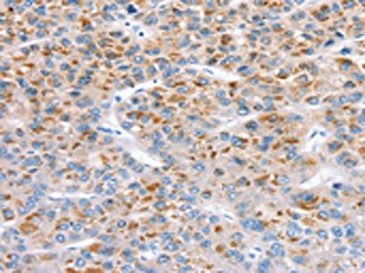 CCS Antibody
