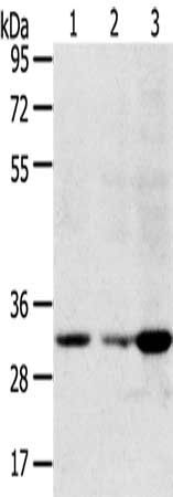 CCS Antibody