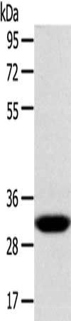 CCS Antibody