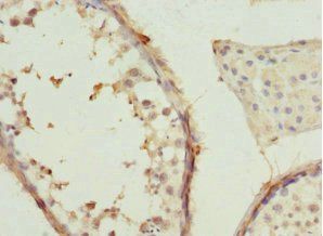 CCT2 Antibody