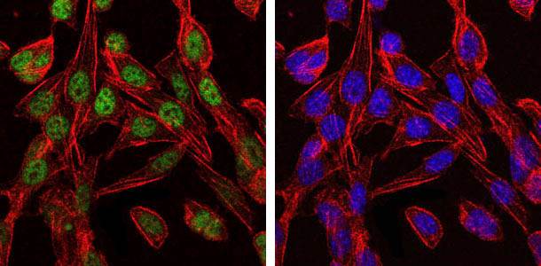 CCT2 Antibody