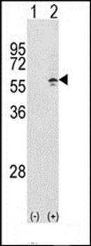 CCT3 antibody