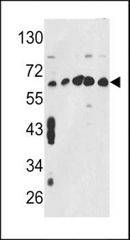 CCT3 antibody