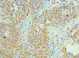 CCT6A Antibody