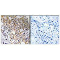 CCT6A Antibody