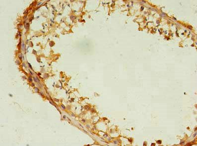 CCT6B Antibody