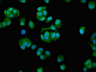 CCT7 antibody