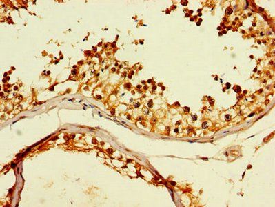 CCT8 Antibody