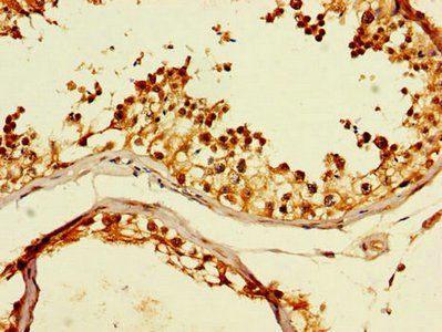 CCT8 antibody