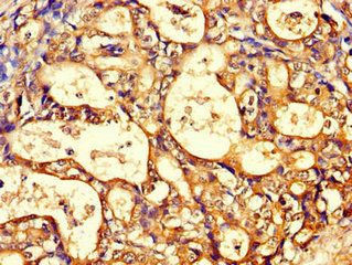 CCT8 Antibody