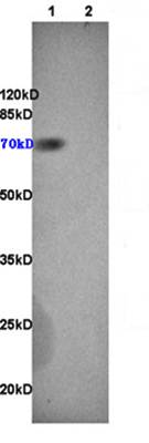 CD105 antibody