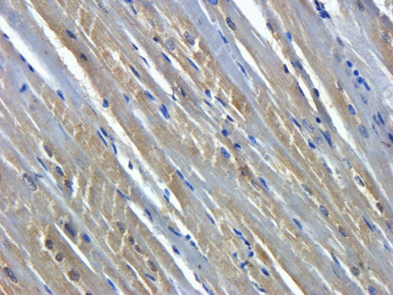 CD105 antibody