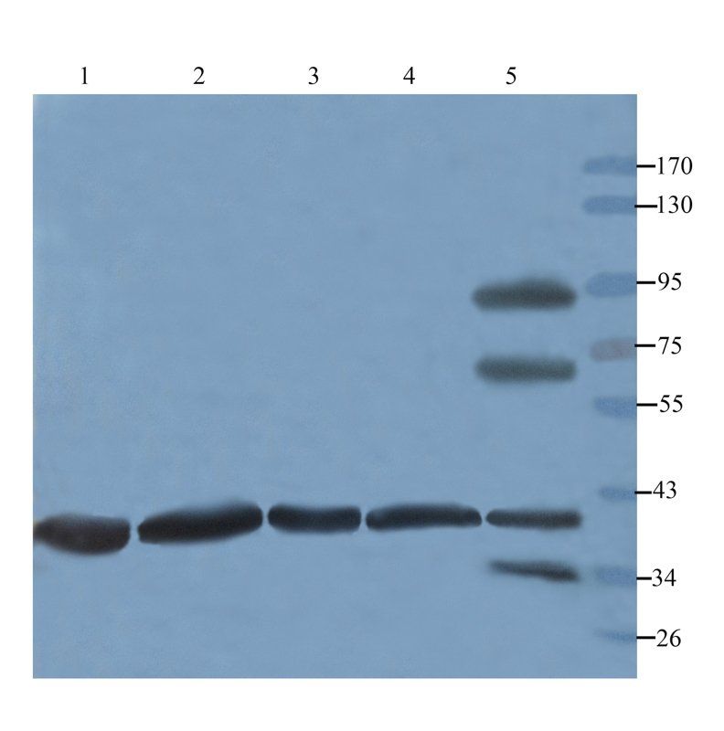 CD105 antibody