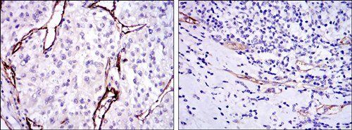 CD105 Antibody