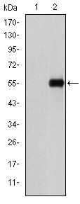 CD105 Antibody