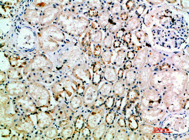 CD106 antibody