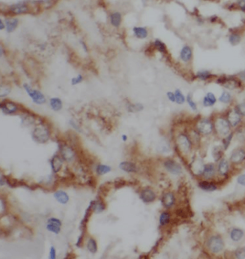 CD10,MME antibody