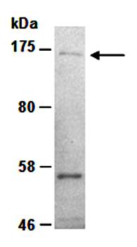 CD117 (C) Antibody, Rabbit Polyclonal