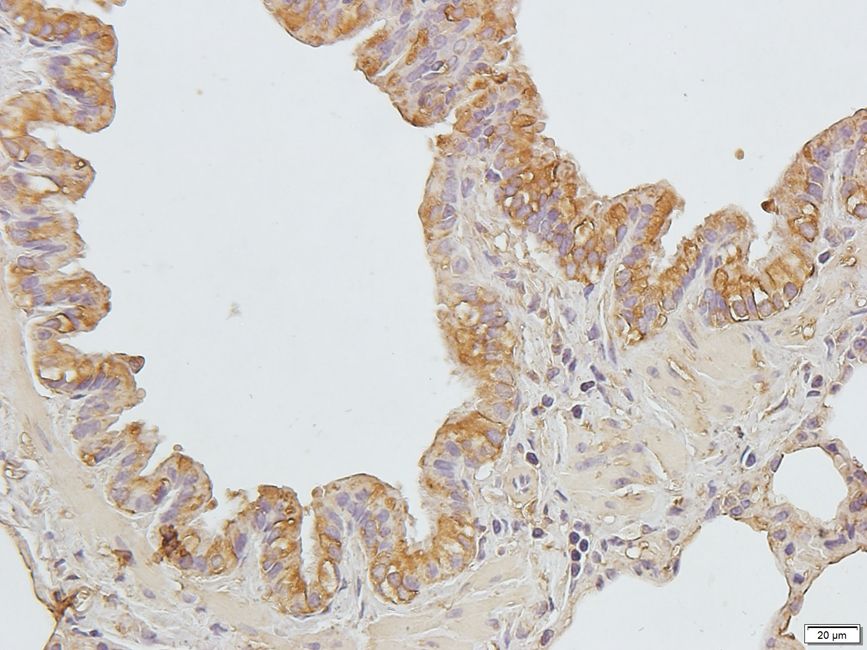 CD11A antibody