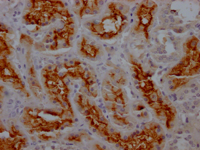 ANPEP Recombinant Monoclonal Antibody