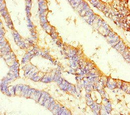 PROM1 Antibody