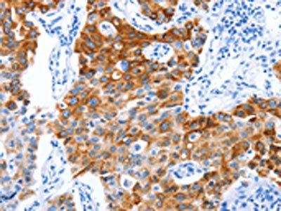 PROM1 Antibody