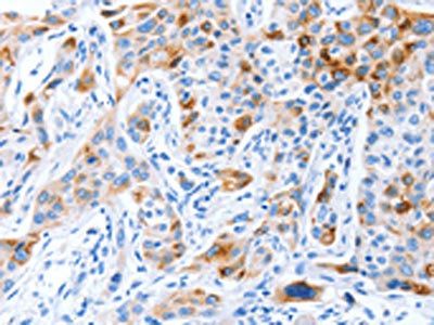 PROM1 Antibody
