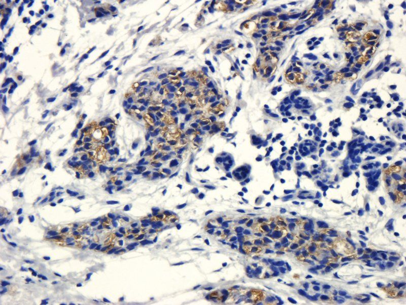 CD133 antibody